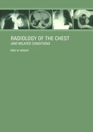 Kniha Radiology of the Chest and Related Conditions Wright