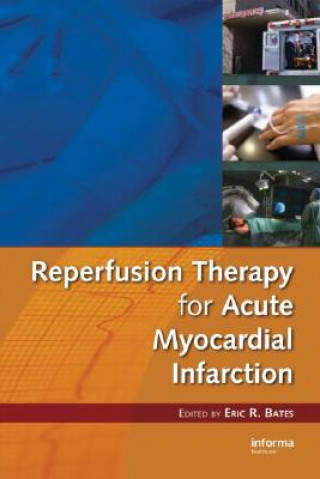 Knjiga Reperfusion Therapy for Acute Myocardial Infarction 