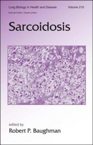 Kniha Sarcoidosis 