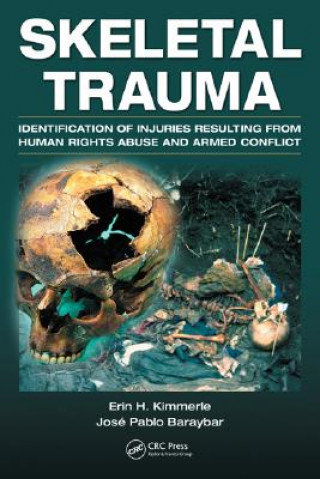 Knjiga Skeletal Trauma Jose Pablo Baraybar