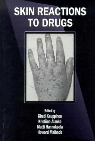 Buch Skin Reactions to Drugs 