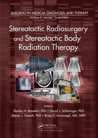 Buch Stereotactic Radiosurgery and Stereotactic Body Radiation Therapy Stanley H. Benedict