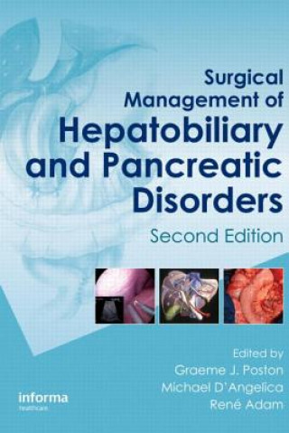 Kniha Surgical Management of Hepatobiliary and Pancreatic Disorders 