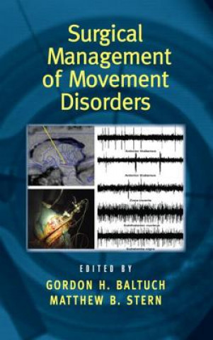 Buch Surgical Management of Movement Disorders 