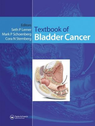 Knjiga Textbook of Bladder Cancer 