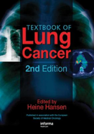 Książka Textbook of Lung Cancer 