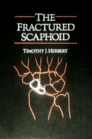 Книга Fractured Scaphoid Herbert