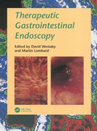 Carte Therapeutic Gastrointestinal Endoscopy A problem-oriented approach 