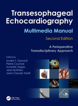 Kniha Transesophageal Echocardiography Multimedia Manual 