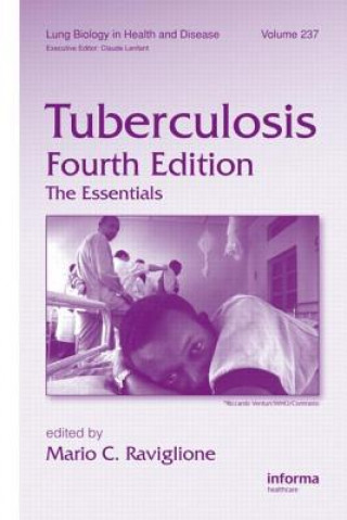 Könyv Tuberculosis 