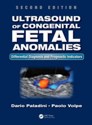 Książka Ultrasound of Congenital Fetal Anomalies Paolo Volpe