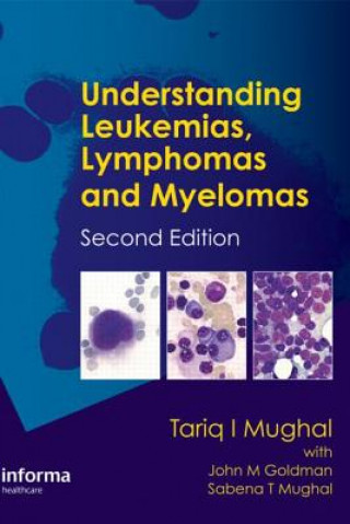 Book Understanding Leukemias, Lymphomas and Myelomas Sabena T. Mughal