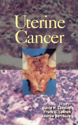 Book Uterine Cancer 