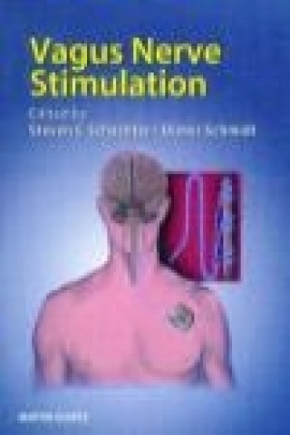 Livre Vagus Nerve Stimulation 