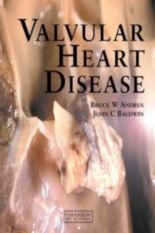 Kniha Valvular Heart Disease John C. Baldwin