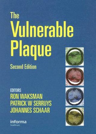 Book Handbook of the Vulnerable Plaque 