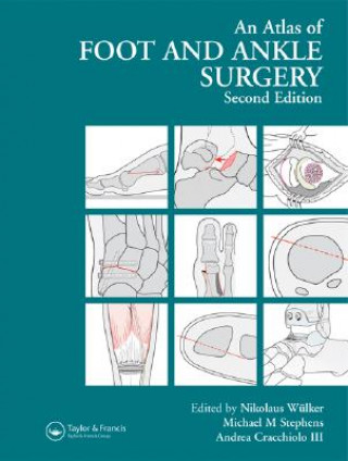 Книга Atlas Foot and Ankle Surgery 