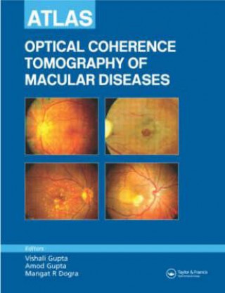 Könyv Atlas of Optical Coherence Tomography of Macular Diseases Vishali Gupta