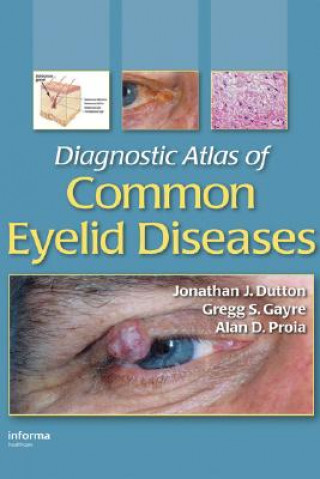 Könyv Diagnostic Atlas of Common Eyelid Diseases Alan D. Proia