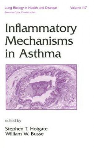 Kniha Inflammatory Mechanisms in Asthma 