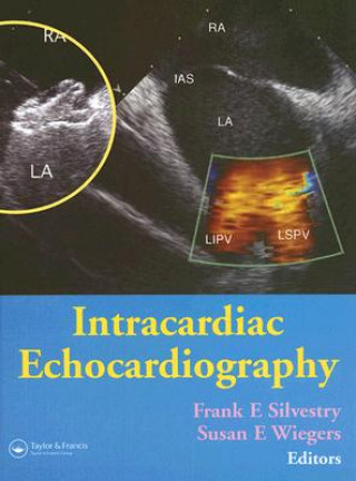 Carte Intracardiac Echocardiography Silvestry Frank E.