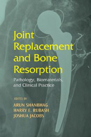 Book Joint Replacement and Bone Resorption 