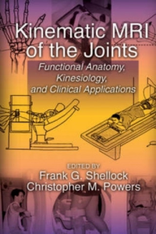 Kniha Kinematic MRI of the Joints Frank G. Shellock