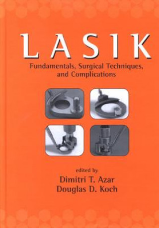 Carte LASIK (Laser in Situ Keratomileusis) 