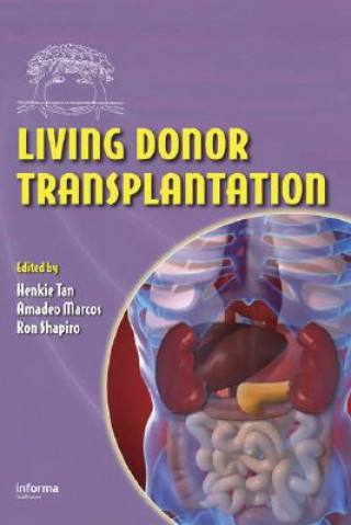 Könyv Living Donor Transplantation 