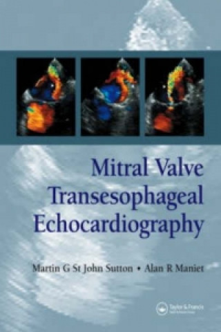 Kniha Mitral Valve Transesophageal Echocardiography Alan R. Maniet