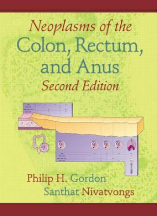 Kniha Neoplasms of the Colon, Rectum, and Anus Philip H. Gordon