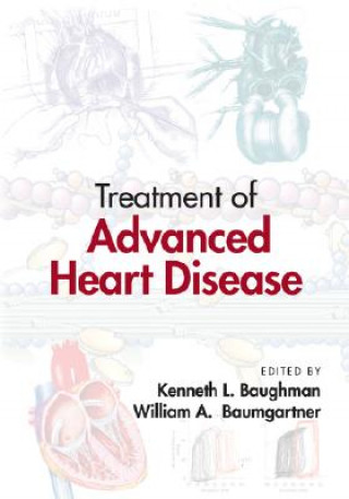 Könyv Treatment of Advanced Heart Disease 