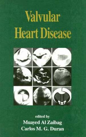 Carte Valvular Heart Disease 