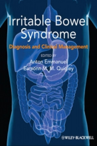 Βιβλίο Irritable Bowel Syndrome Anton Emmanuel