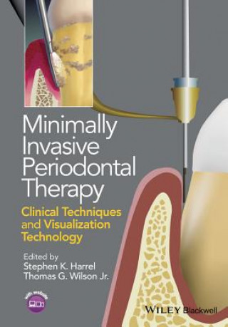 Книга Minimally Invasive Periodontal Therapy - Clinical Techniques and Visualization Technology Thomas G. Wilson
