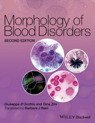 Kniha Morphology of Blood Disorders 2e GIUSEPPE D'ONOFRIO