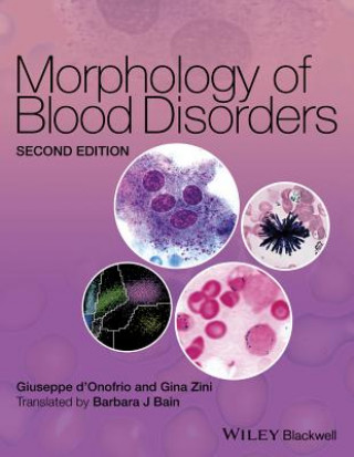 Книга Morphology of Blood Disorders 2e GIUSEPPE D'ONOFRIO