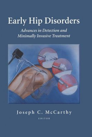 Kniha Early Hip Disorders Joseph C. McCarthy