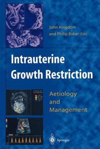 Könyv Intrauterine Growth Restriction Philip Baker