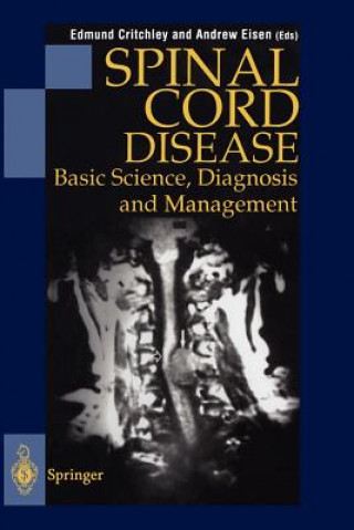 Carte Spinal Cord Disease Edmund Critchley