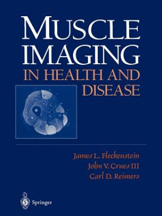 Carte Muscle Imaging in Health and Disease John V. III Crues
