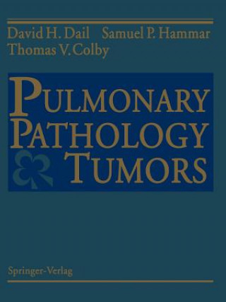 Kniha Pulmonary Pathology - Tumors David H. Dail