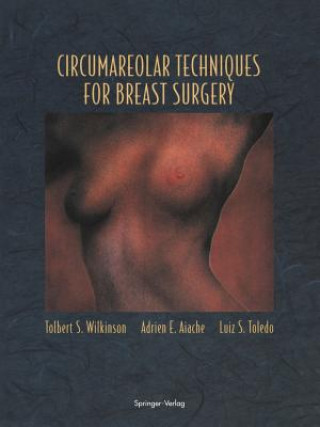 Könyv Circumareolar Techniques for Breast Surgery Tolbert S. Wilkinson