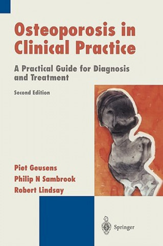 Könyv Osteoporosis in Clinical Practice Piet Geusens