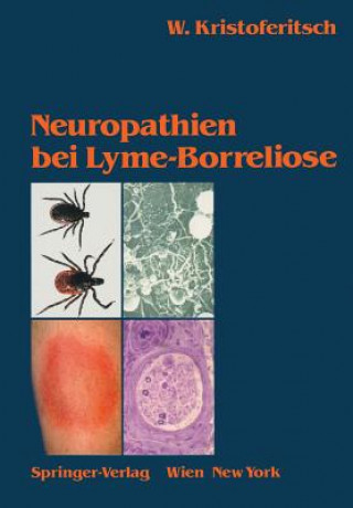 Könyv Neuropathien Bei Lyme-Borreliose Wolfgang Kristoferitsch