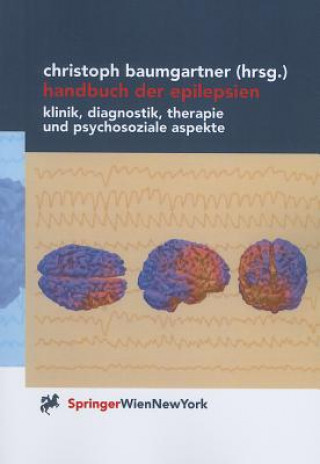 Könyv Handbuch der Epilepsien Christoph Baumgartner
