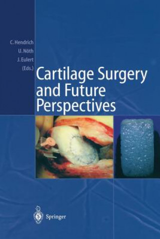 Könyv Cartilage Surgery and Future Perspectives Jochen Eulert