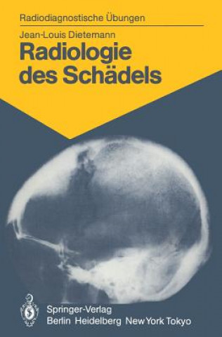 Kniha Radiologie des Schadels Jean-Louis Dietemann