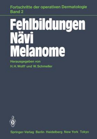 Könyv Fehlbildungen Navi Melanome W. Schmeller