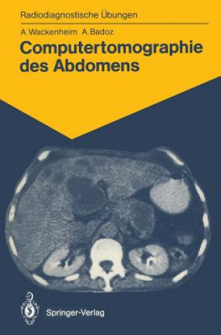 Könyv Computertomographie des Abdomens Auguste Wackenheim